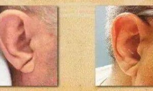 嘴唇发紫是心脏在“求救”？心脏不好的人，脸上会“报警”